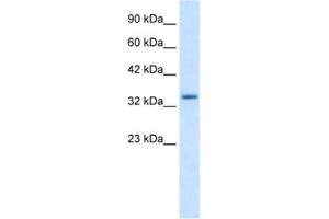 Western Blotting (WB) image for anti-Zinc Finger Protein 134 (ZNF134) antibody (ABIN2461188)