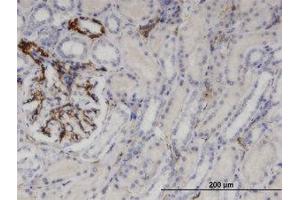 Image no. 1 for anti-Uridine Phosphorylase 1 (UPP1) (AA 1-93) antibody (ABIN599461) (UPP1 antibody  (AA 1-93))