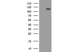 Image no. 2 for anti-Myoneurin (MYNN) (AA 10-300) antibody (ABIN1490790) (Myoneurin antibody  (AA 10-300))