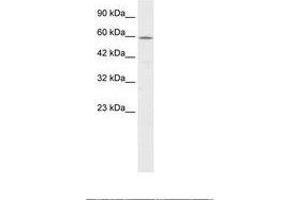 Image no. 1 for anti-Chaperonin Containing TCP1, Subunit 4 (Delta) (CCT4) (AA 453-502) antibody (ABIN6735873) (CCT4 antibody  (AA 453-502))