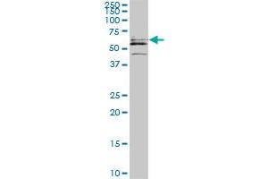 Western Blotting (WB) image for anti-Cytidine and DCMP Deaminase Domain Containing 1 (CDADC1) (AA 423-515) antibody (ABIN466247) (CDADC1 antibody  (AA 423-515))