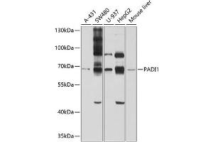 Western blot analysis of extracts of various cell lines, using P antibody (ABIN6128528, ABIN6145161, ABIN6145162 and ABIN6214293) at 1:1000 dilution. (PADI1 antibody  (AA 1-260))