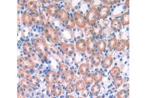 Used in DAB staining on fromalin fixed paraffin- embedded Kidney tissue (UBAP1 antibody  (AA 1-224))