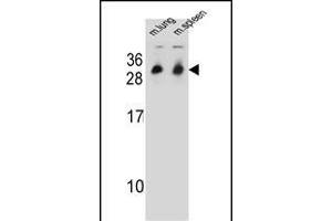 CYB561D1 Antibody (C-term) (ABIN654999 and ABIN2844633) western blot analysis in mouse lung,spleen tissue lysates (35 μg/lane).