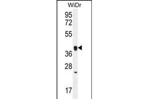 OR2T8 Antibody (C-term) (ABIN656071 and ABIN2845419) western blot analysis in WiDr cell line lysates (35 μg/lane).