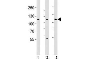 Western blot analysis of lysate from 1) HT-29, 2) HeLa, and 3) Jurkat cell line using JAK1 antibody; Ab was diluted at 1:1000.