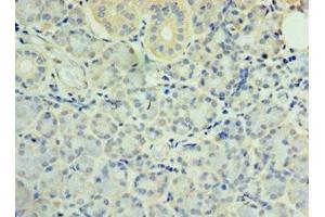 Immunohistochemistry of paraffin-embedded human pancreatic tissue using ABIN7171160 at dilution of 1:100 (SYT4 antibody  (AA 38-190))