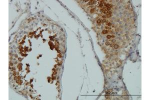 Immunoperoxidase of monoclonal antibody to AKT1 on formalin-fixed paraffin-embedded human testis. (AKT1 antibody  (AA 1-480))