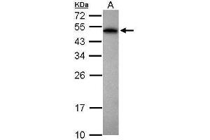WB Image Sample (30 ug of whole cell lysate) A: Jurkat 12% SDS PAGE antibody diluted at 1:1000 (PABPN1 antibody)