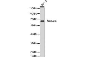 Western blot analysis of extracts of DU145 cells, using Occludin antibody (ABIN6129067, ABIN6144995, ABIN6144997 and ABIN6216324) at 1:1000 dilution. (Occludin antibody  (AA 350-450))