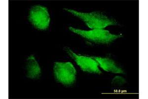 Immunofluorescence of purified MaxPab antibody to FGF1 on HeLa cell. (FGF1 antibody  (AA 1-155))