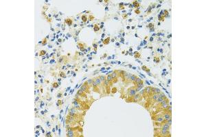 Immunohistochemistry of paraffin-embedded mouse lung using SLC37 antibody (ABIN7270453) at dilution of 1:100 (40x lens).