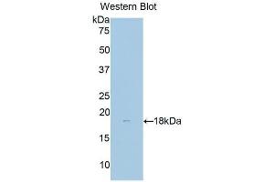 Detection of Recombinant dLK1, Human using Polyclonal Antibody to Delta Like 1 Homolog (dLK1) (DLK1 antibody  (AA 177-326))