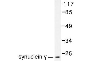 Image no. 1 for anti-Synuclein, gamma (Breast Cancer-Specific Protein 1) (SNCG) antibody (ABIN271916) (SNCG antibody)