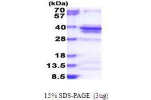 SDS-PAGE (SDS) image for Ribosomal Protein L5 (RPL5) (AA 1-297) protein (His tag) (ABIN5853836)