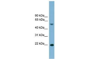 Human Spleen; WB Suggested Anti-HDGFRP3 Antibody Titration: 0. (HDGFRP3 antibody  (Middle Region))