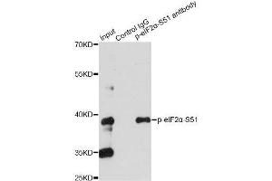 Immunoprecipitation analysis of 200ug extracts of HeLa cells treated by CA using 2. (EIF2S1 antibody  (pSer51))