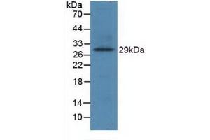 Western blot analysis of recombinant Human TLR8. (TLR8 antibody  (AA 844-1039))