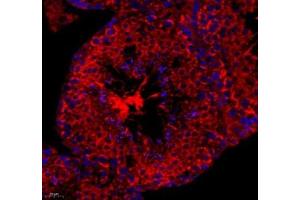 Immunofluorescence of paraffin embedded mouse spleen using cfap58 (ABIN7073535) at dilution of 1: 650 (400x lens) (CCDC147 antibody)