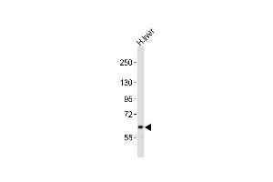 Anti-NOTCH4 Antibody (C-term)at 1:2000 dilution + human liver lysates Lysates/proteins at 20 μg per lane. (NOTCH4 antibody  (C-Term))