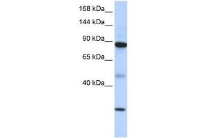 WB Suggested Anti-TDRD9 Antibody Titration: 0. (TDRD9 antibody  (Middle Region))