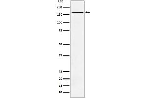 Western blot analysis of AGL expression in K562 cell lysate. (Recombinant AGL antibody)