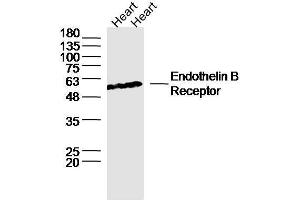 Lane 1: Rat heart lysates, Lane 2: Mouse heart lysates probed with ETBR/Endothelin B Receptor Polyclonal Antibody, unconjugated  at 1:300 overnight at 4°C followed by a conjugated secondary antibody for 60 minutes at 37°C. (EDNRB antibody  (AA 378-442))