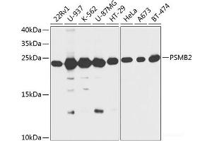 Western blot analysis of extracts of various cell lines using PSMB2 Polyclonal Antibody at dilution of 1:1000. (PSMB2 antibody)