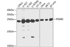 Western blot analysis of extracts of various cell lines using PSMB2 Polyclonal Antibody at dilution of 1:1000. (PSMB2 antibody)