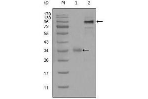 Western Blot showing ETV1 antibody used against truncated Trx-ETV1 recombinant protein (1) and full-length ETV1 (aa1-477)-hIgGFc transfected CHO-K1 cell lysate (2). (ETV1 antibody  (AA 1-191))