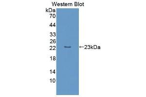 Western blot analysis of the recombinant protein. (OPA3 antibody  (AA 11-179))