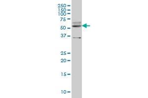 STAU2 monoclonal antibody (M04), clone 1B9 Western Blot analysis of STAU2 expression in IMR-32 .