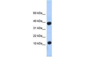 Image no. 1 for anti-Pterin-4 alpha-Carbinolamine Dehydratase/dimerization Cofactor of Hepatocyte Nuclear Factor 1 alpha (PCBD1) (N-Term) antibody (ABIN6740300) (PCBD1 antibody  (N-Term))