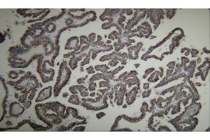 Immunohistochemistry (IHC) image for anti-alpha-Methylacyl-CoA Racemase (AMACR) (AA 367-381), (C-Term) antibody (ABIN7598787)