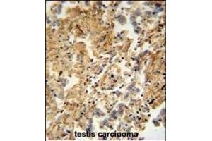 ZMYND10 Antibody (C-term) (ABIN652018 and ABIN2840499) immunohistochemistry analysis in formalin fixed and paraffin embedded human testis carcinoma followed by peroxidase conjugation of the secondary antibody and DAB staining. (ZMYND10 antibody  (C-Term))