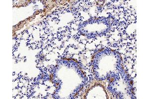Immunohistochemistry (antigen was repair with 0.