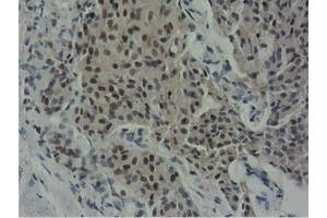 Image no. 13 for anti-5'-Nucleotidase Domain Containing 1 (NT5DC1) antibody (ABIN1499838)