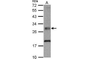 Western Blotting (WB) image for anti-Thiamin Pyrophosphokinase 1 (TPK1) antibody (ABIN2855729)