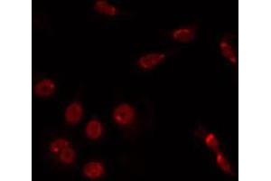 ABIN6266768 staining HuvEc by IF/ICC. (TINF2 antibody  (Internal Region))