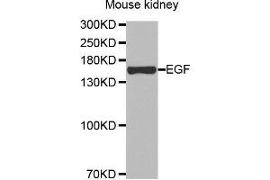 Western Blotting (WB) image for anti-Epidermal Growth Factor (EGF) antibody (ABIN3016522) (EGF antibody)