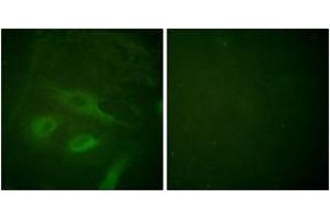 Immunofluorescence analysis of HeLa cells, using IkappaB-epsilon (Ab-22) Antibody. (IkappaB-epsilon antibody  (AA 131-180))