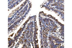 IHC analysis of MLX-interacting protein/MLXIP using anti-MLX-interacting protein/MLXIP antibody (ABIN7602593). (MLXIP antibody  (AA 88-348))