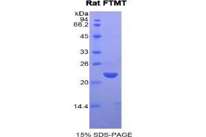 SDS-PAGE analysis of Rat FTMT Protein. (Ferritin Mitochondrial Protein)