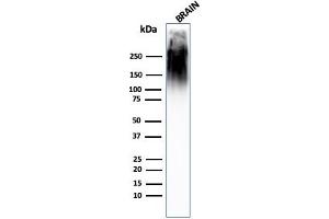Western Blot Analysis of human brain tissue lysate using Neurofilament MAb (SPM563). (NEFH antibody)