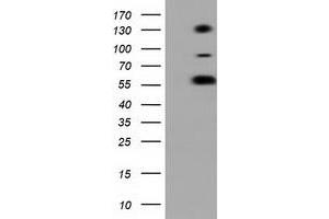 HEK293T cells were transfected with the pCMV6-ENTRY control (Left lane) or pCMV6-ENTRY BTN1A1 (Right lane) cDNA for 48 hrs and lysed. (BTN1A1 antibody)