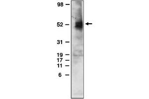 Western Blotting (WB) image for anti-Sphingosine-1-Phosphate Receptor 4 (S1PR4) (C-Term) antibody (ABIN264453) (S1PR4 antibody  (C-Term))