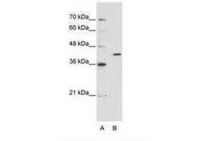 Image no. 1 for anti-Exoribonuclease 1 (ERI1) (AA 231-280) antibody (ABIN202308) (ERI1 antibody  (AA 231-280))