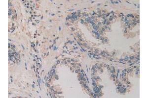 IHC-P analysis of Human Prostate Gland Tissue, with DAB staining. (CACYBP antibody  (AA 2-228))