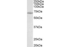 Antibody (0. (SLC6A8 antibody  (Internal Region))