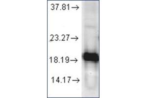 Image no. 1 for anti-Superoxide Dismutase 1, Soluble (SOD1) antibody (ABIN264854) (SOD1 antibody)